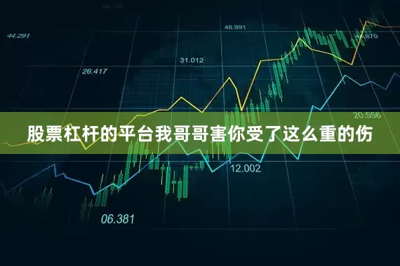 股票杠杆的平台我哥哥害你受了这么重的伤